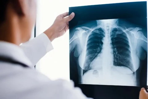 Prefeitura de Balsa Nova planeja reinstalação de Raio X no Centro Médico Bom Jesus